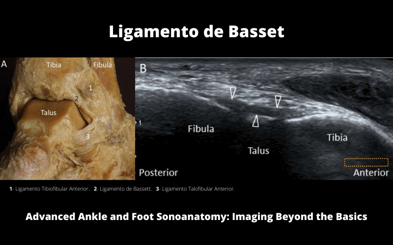 Basset Ecografia y Anatomia.png